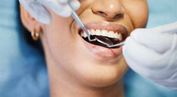 Best Dental Fillings (Composite and Amalgam)  in Edgeworth, PA